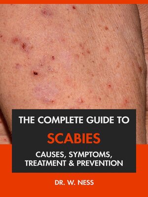 cover image of The Complete Guide to Scabies